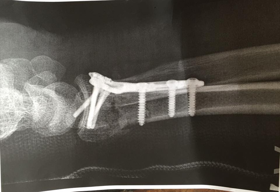 11148649_965428196841096_5255859207836290394_n